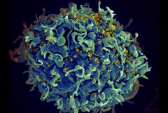 HIV infecting T cell